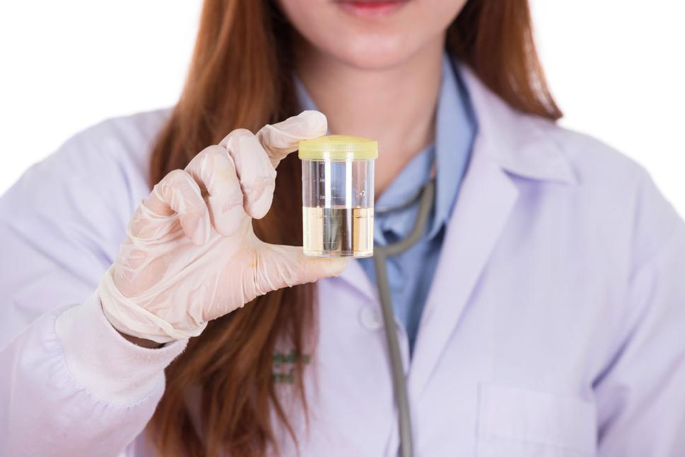 Here’s what you need to know about e coli in urine